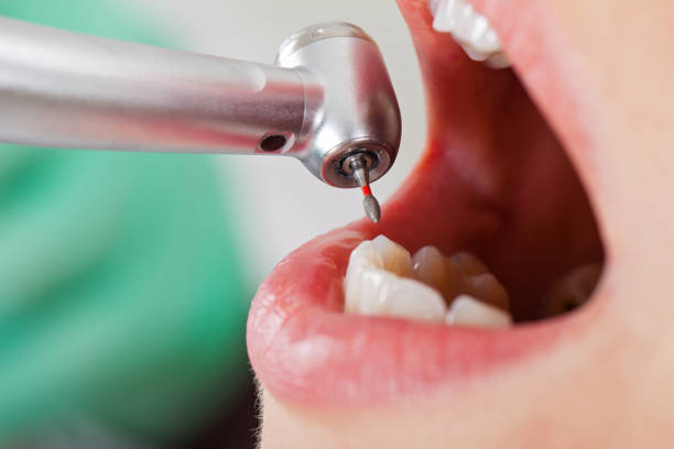 Best Urgent Tooth Repair  in Norway, MI